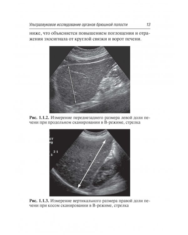 Ультразвуковая диагностика