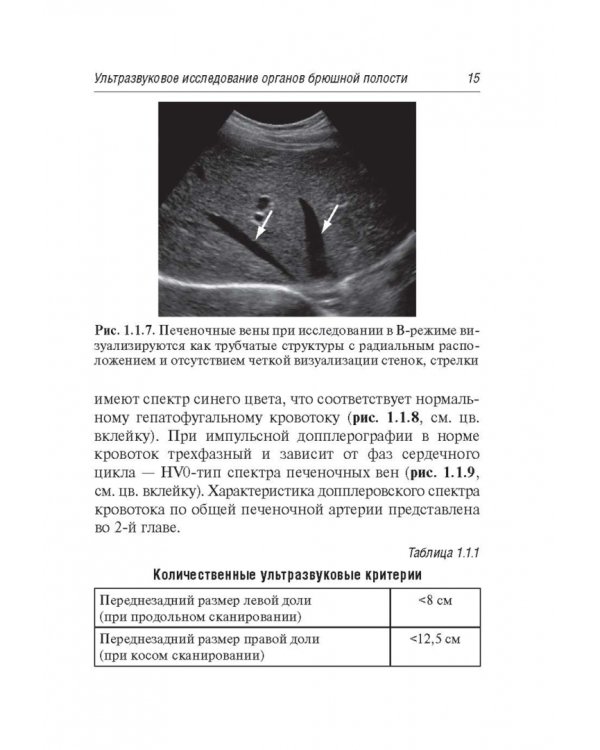 Ультразвуковая диагностика