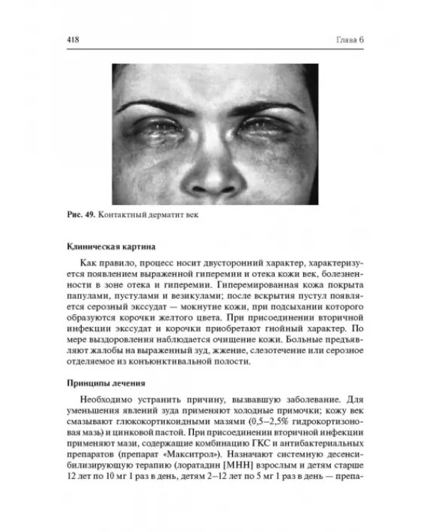 Дополнительное изображение книги «Офтальмофармакология. Руководство для врачей»