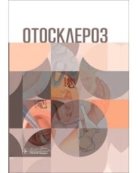 Отосклероз