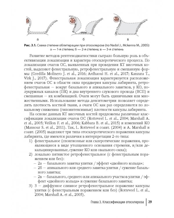 Дополнительное изображение книги «Отосклероз»