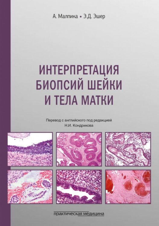 Обложка книги «Интерпретация биопсий шейки и тела матки» — Малпика Анаис, Эшер Элизабет Д., ISBN 9785988119029