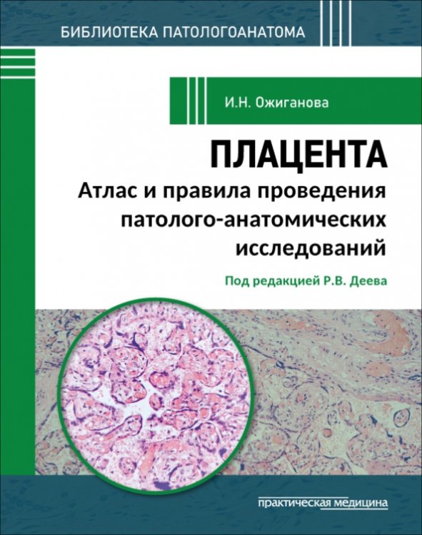 Обложка книги «Плацента. Атлас и правила проведения патолого-анатомических исследований» — Ожиганова Ирина Николаевна, ISBN 9785988118251