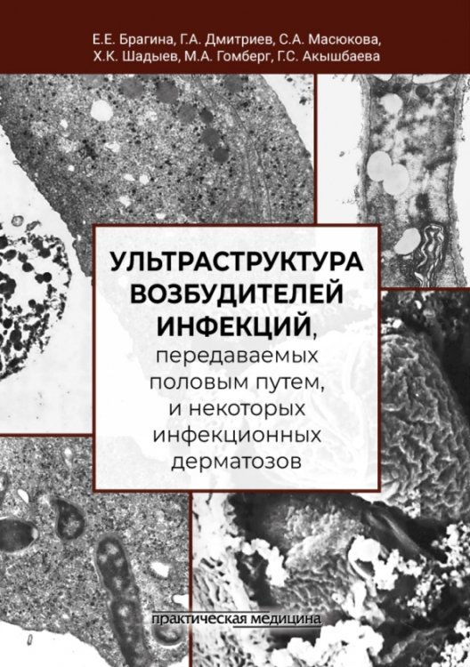 Обложка книги «Ультраструктура возбудителей инфекций, передаваемых половым путем» — Дмитриев Георгий Александрович, Масюкова Светлана Андреевна, Брагина Елизавета Ефимовна, ISBN 9785988117919