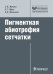 Пигментная абиотрофия сетчатки: руководство