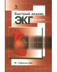 Быстрый анализ ЭКГ