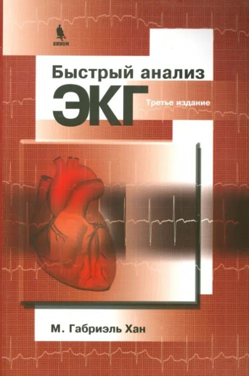 Быстрый анализ ЭКГ Быстрый анализ ЭКГ