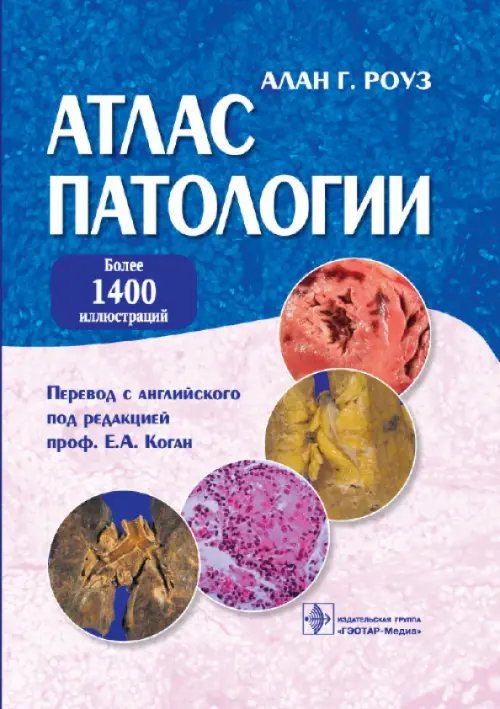 Атлас патологии. Макро- и микроскопические изменения органов Атлас патологии. Макро- и микроскопические изменения органов